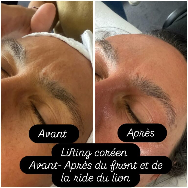 550294367_18075873641092924_2022549213455153268_n